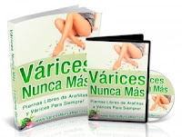 como quitar varices naturalmente