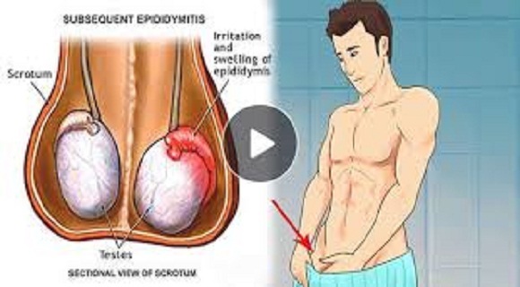 MUST READ GUYS!!! Signs And Symptoms Of Testicular Cancer Men Should Be Afraid Of 