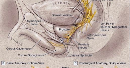 brady urology at johns hopkins hospital a strategic approach to Prostate Treatment brady urology at johns hopkins hospital a strategic approach to erection recovery after radical prostatectomy