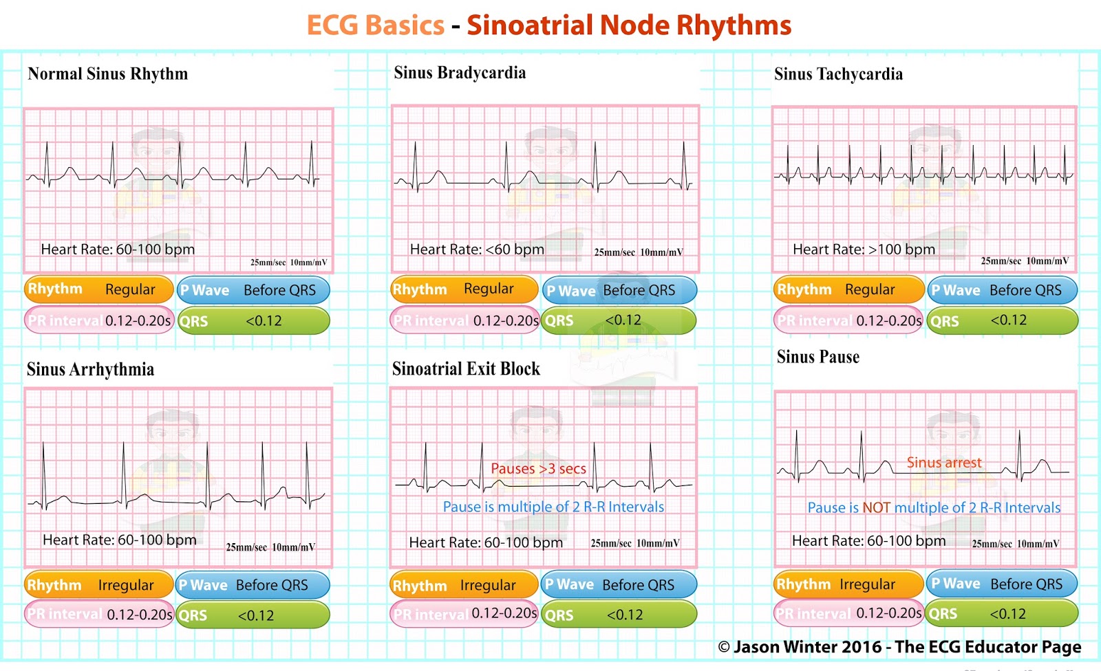 3. EKG Heart Rhythm Nails - wide 8