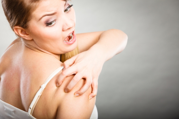 Cara Menghilangkan Panu Secara Alami, Cepat dan Ampuh Cara Menghilangkan Panu Secara Alami, Cepat dan Ampuh