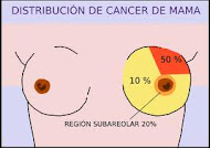 Distribución de cáncer de mama