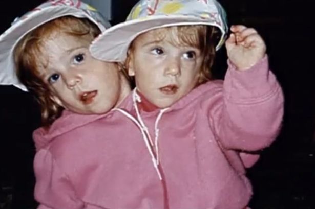 A história das gêmeas Abigail e Brittany Hensel - Curioso e Cia.