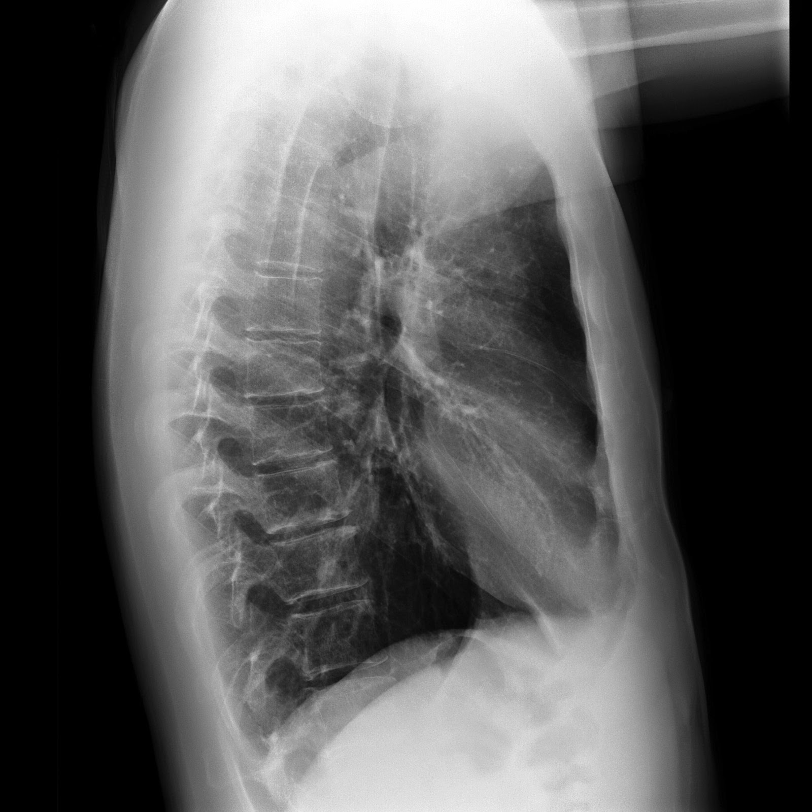 Im Med Student Diagnosis Of Previous Case