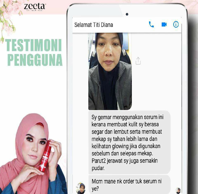 Atasi Masalah Jerawat & Jeragat Dengan Rose Face Serum Zeeta rose face serum, rfs, testimoni rfs, serum jerawat & jeragat