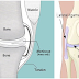 Reasons For Joint Discomfort 