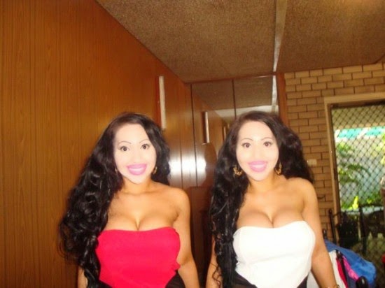 Anna and Lucy DeCinque: Freaky Cosmetic Surgery Twins 
