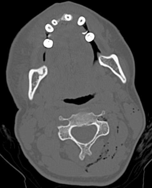 Bizarre case of a failed suicide attempt (Christmas on duty)