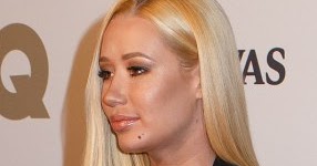 Iggy Azalea, her boobs & the tape that was supposed to hold it up, step