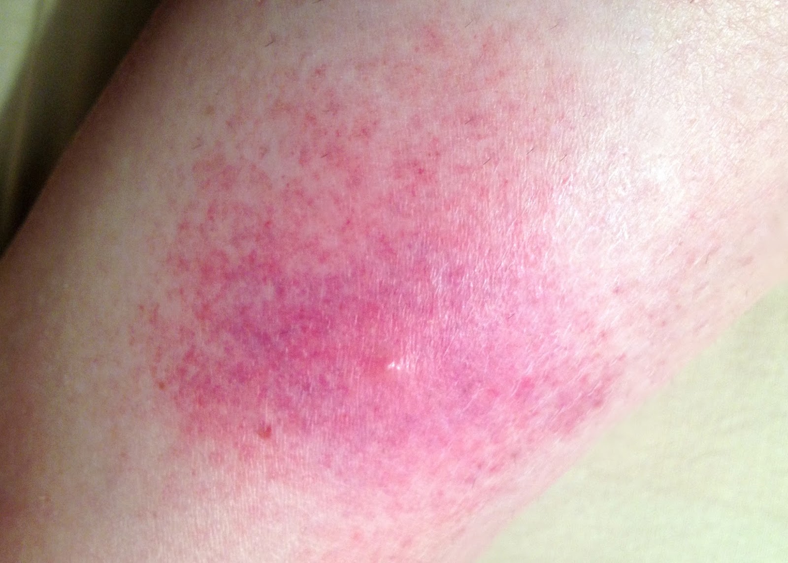 Quotes About Spider Bites. QuotesGram