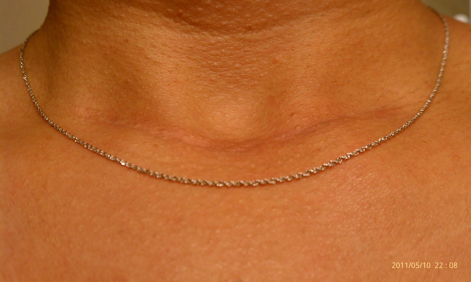 How Does My Neck Look May 2011