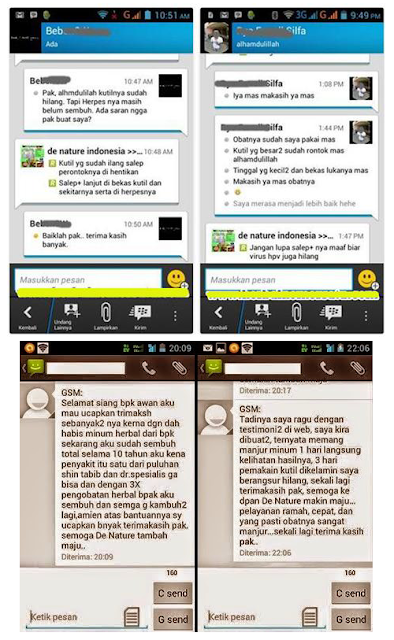 Cara Merontokkan Kutil Pada Kelamin Tanpa Harus Operasi Cara Merontokkan Kutil Pada Kelamin Tanpa Harus Operasi