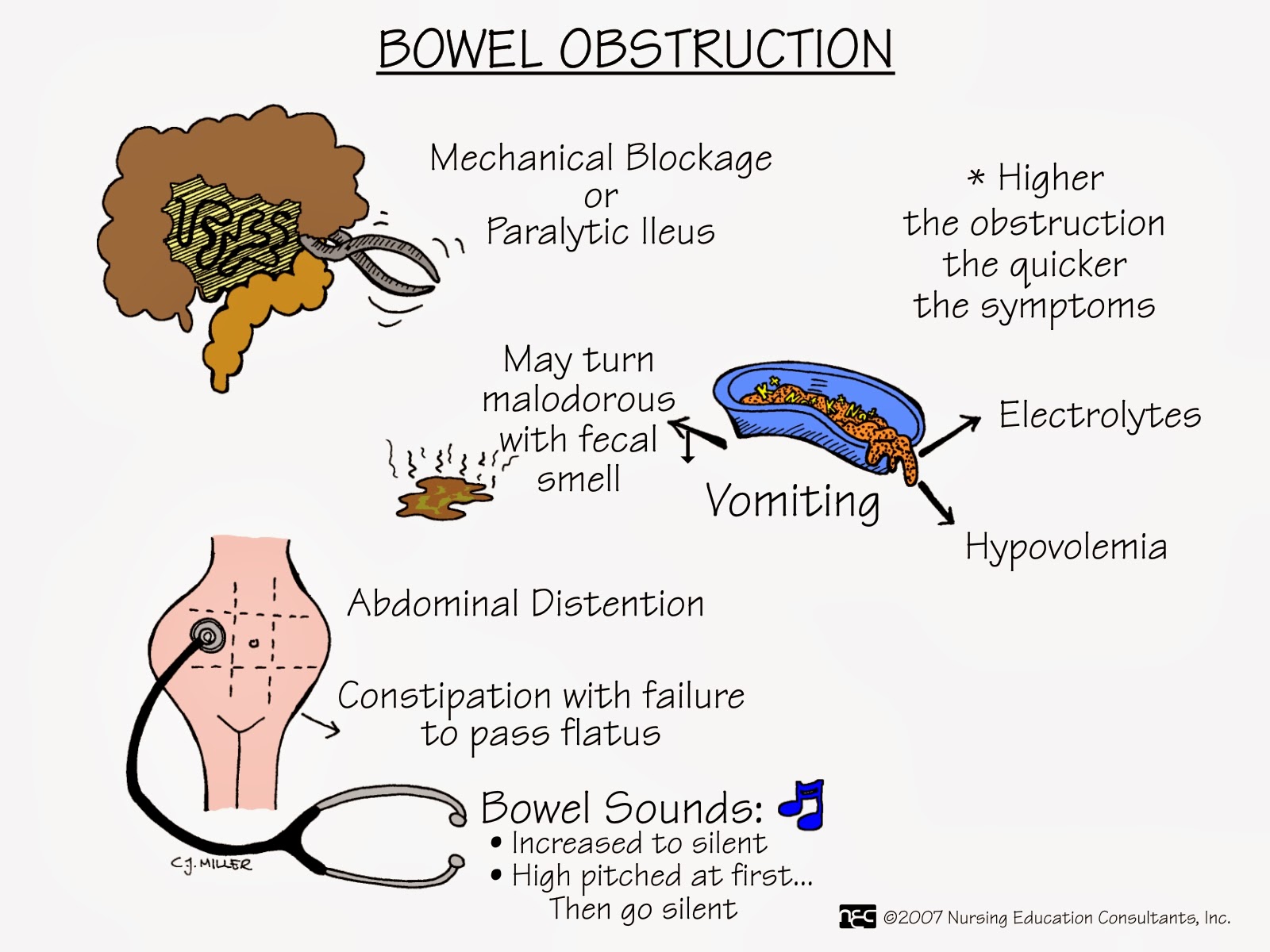 Nurses Notes MS NURSING MNEMONICS Nursing mnemonics