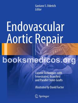 Endovascular Aortic Repair Gustavo S. Oderich pdf