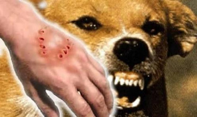 Waspada Rabies! 32 Orang Sudah Jadi Korban, Segera Vaksin Hewan Peliharaan Anda Waspada Rabies! 32 Orang Sudah Jadi Korban, Segera Vaksin Hewan Peliharaan Anda