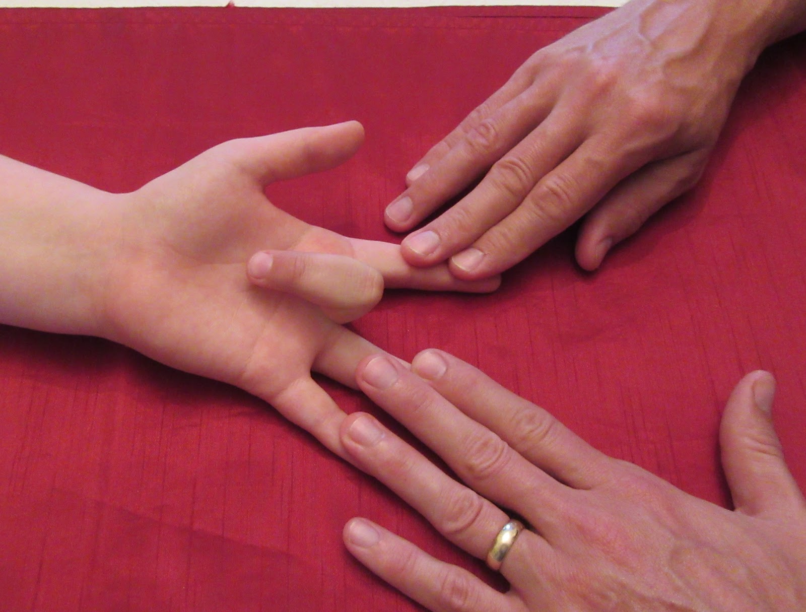 Paediatrics For Primary Care and Anyone Else Minor Injuries Three 