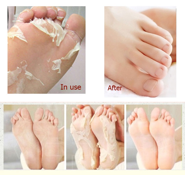 делать пилинг ног