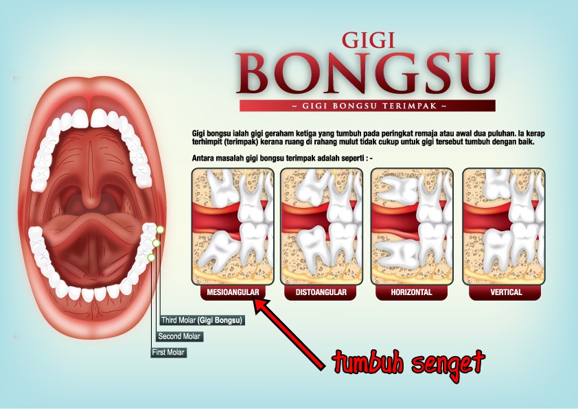 Belog Miss Kinuko SAKIT GIGI YANG TERAMAT!