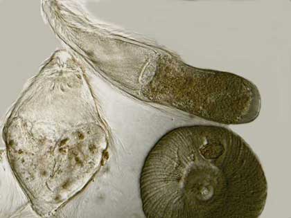 Triconympha sp. contoh species Flagellata Filum Protozoa (Protista Mirip Hewan)