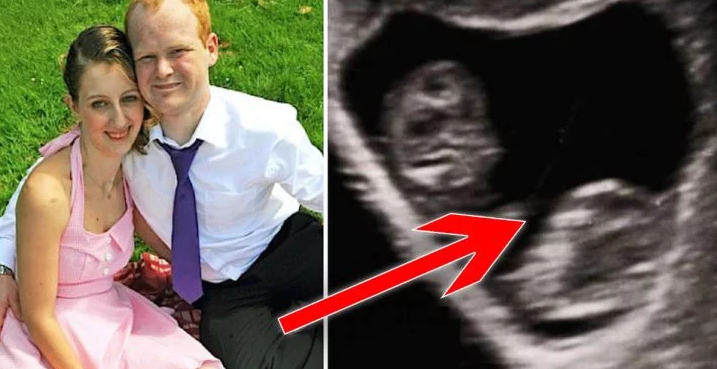 A 19-year-old Girl Is Pregnant With Twins 