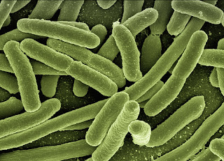 Legionella pneuomphila Legionella sierotipo 1