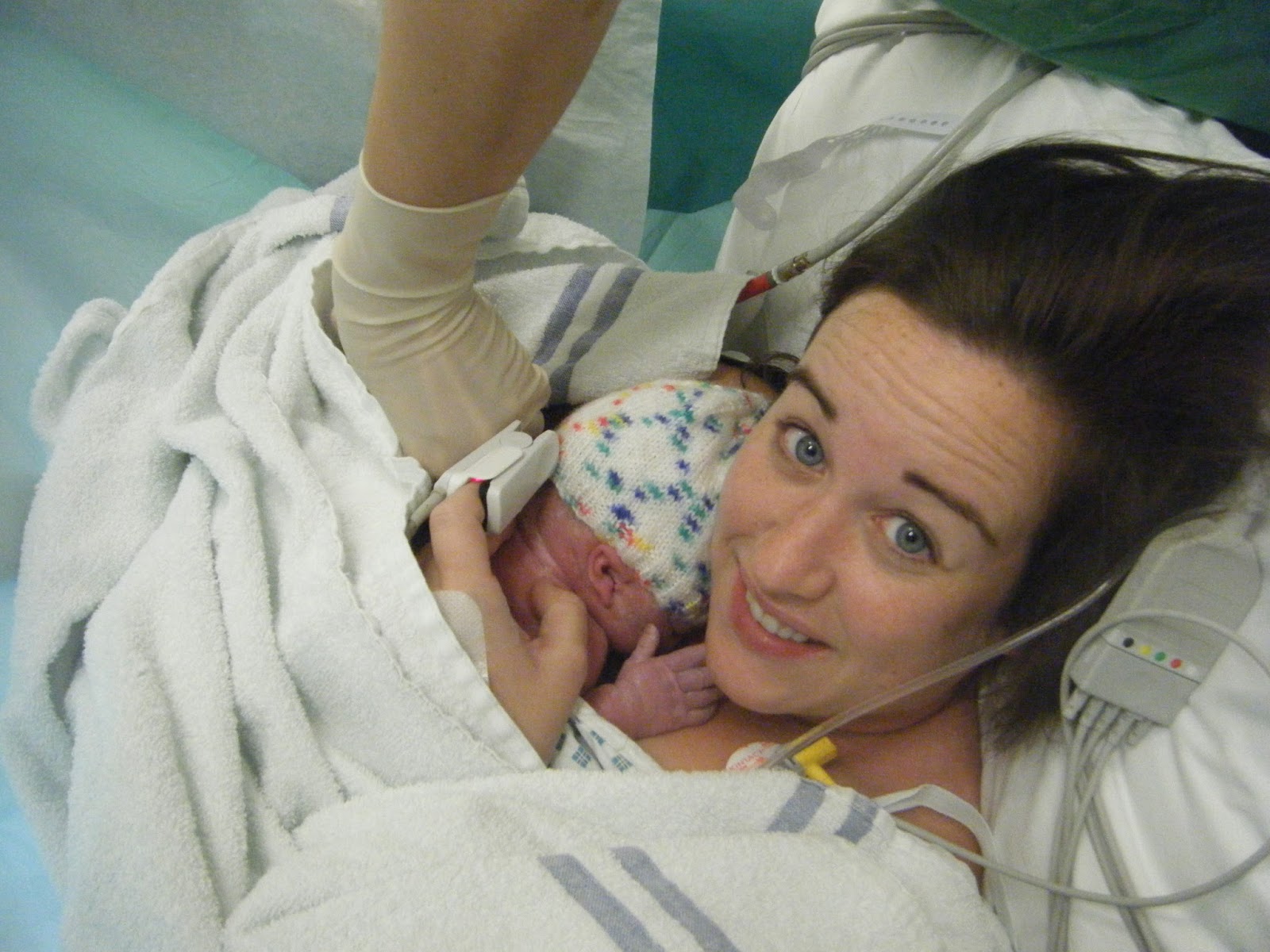 Twin Mothership MCDA Twins Delivery Elective Cesarean Section