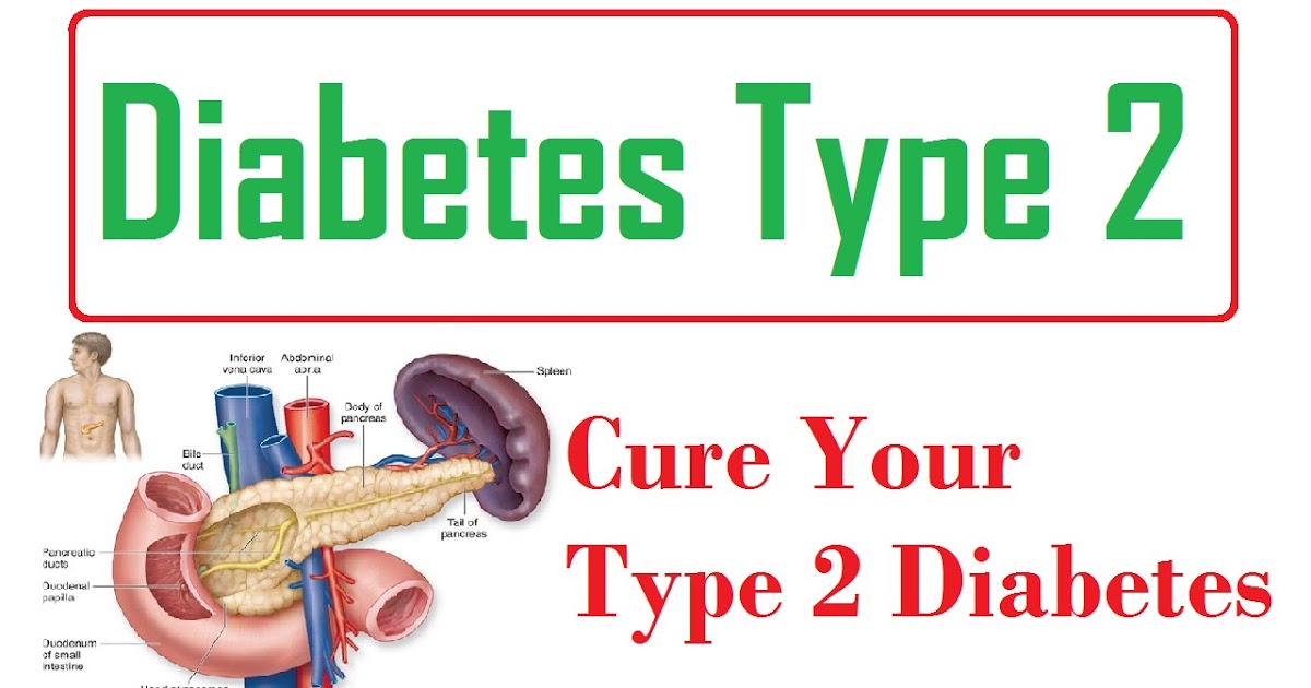 Best Home Remedies Type 2 Diabetes Symptoms, Treatment, Diet