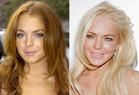 Lindsay Lohan Plastic Surgery