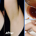 In 2 Minutes Get Rid Of Underarm Hair Naturally And Effectively Using These Home Made Remedies!