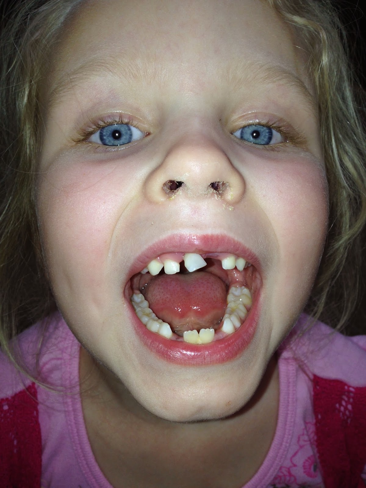 to the Krazy Kingdom Toothless Yet Again + More