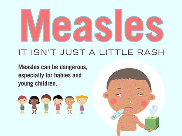 DOH says Measles cases to Lessen on Early May this Year