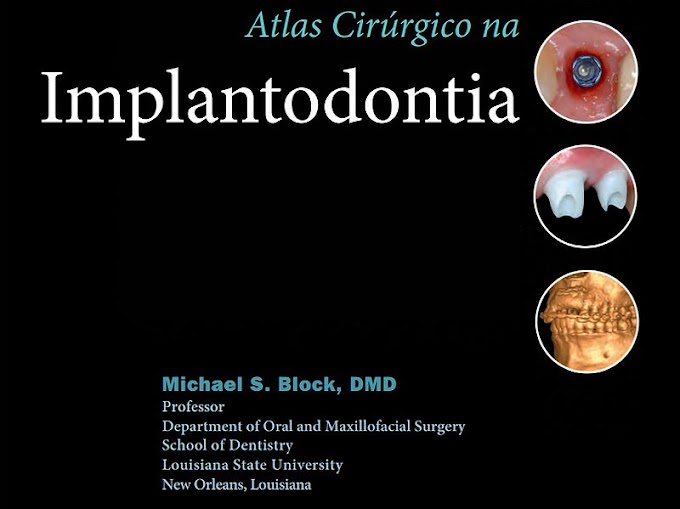 PDF: Atlas Cirúrgico na Implantodontia