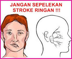 penyakit stroke