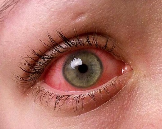 corso di make up dermatologia cosmetologia pelli problematiche corso di make up dermatologia cosmetologia pelli problematiche