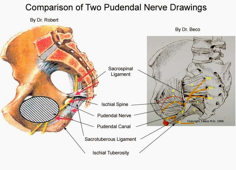 Pudendal nerve entrapment syndrome | DermNet New Zealand