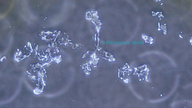 HD camera image of cheek cells under a phase contrast microscope.