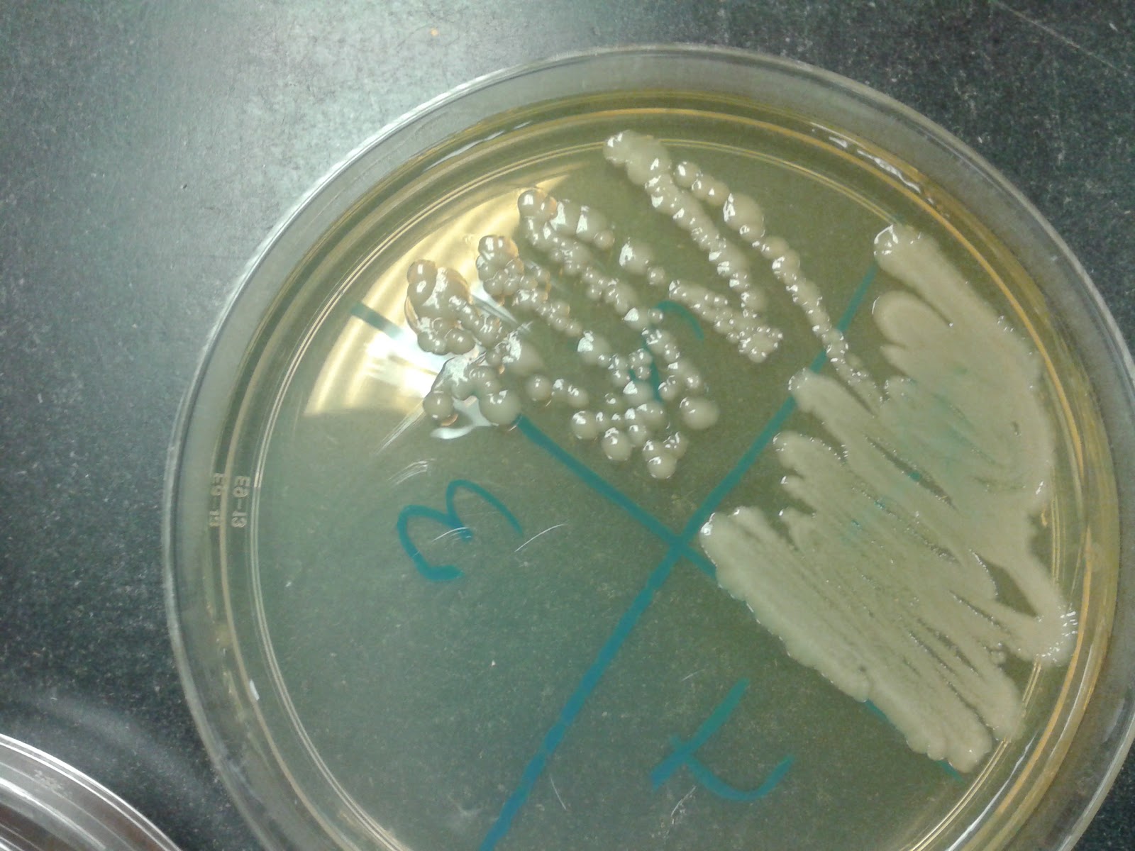Microbiology EJournal Day 18Picked isolated colony from the TSA and