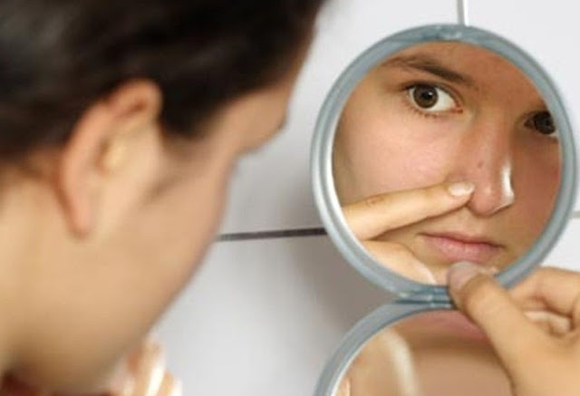 Mau Jerawat Hilang Secara Kilat Hanya Dalam Waktu 1 Malam Saja? Begini Caranya Mau Jerawat Hilang Secara Kilat Hanya Dalam Waktu 1 Malam Saja? Begini Caranya