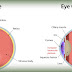 Five Simple Eye Test Can Detect Glaucoma