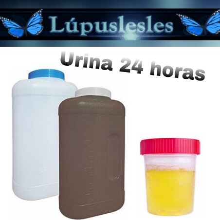 O que sao piocitos no exame de urina
