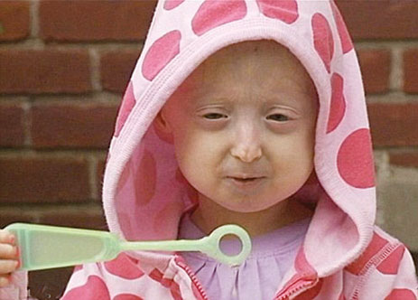 FranovikGivesBack: Franovik gives back to Progeria Charities