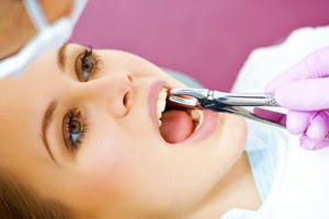 Nhổ răng cấm bị đau nhức khi nào?