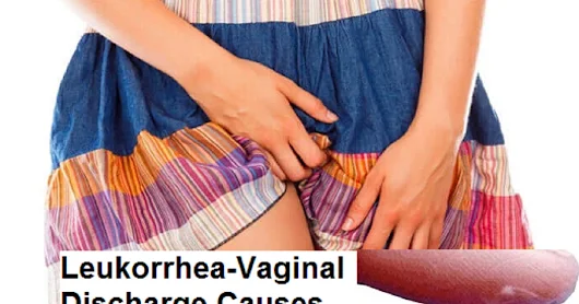 vaginal discharge leukorrhea Vaginal discharge leukorrhea