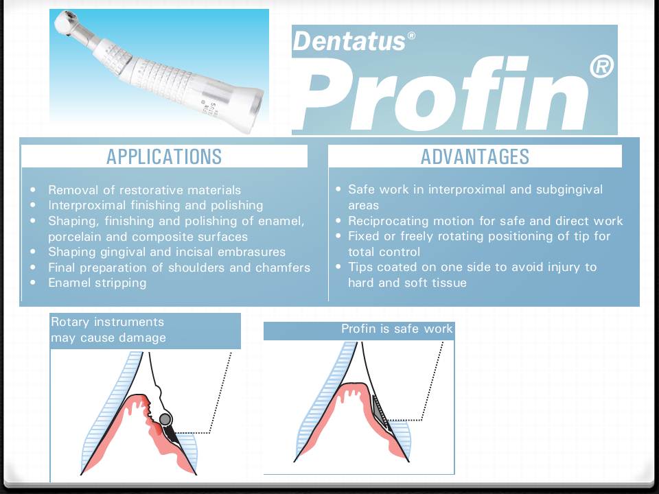 DOs and DONTs in DENTISTRY Polishing Composite Restorations EASY