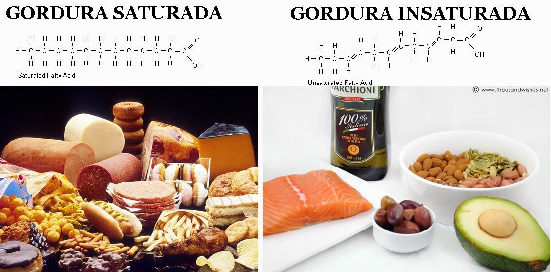 Caderno de Medicina: Gordura: vilã ou mocinha?