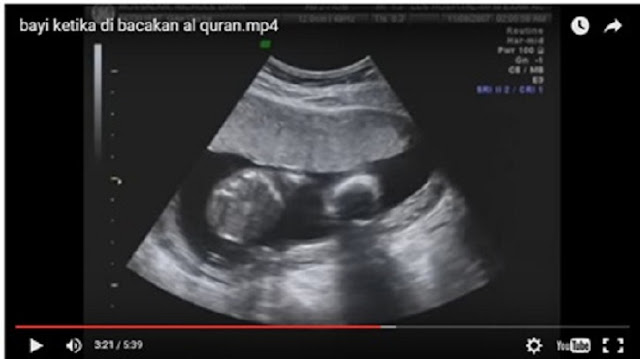 Masyaallah, Bayi Dalam Kandungan Ini Sujud Saat Dibacakan Ayat Al Quran