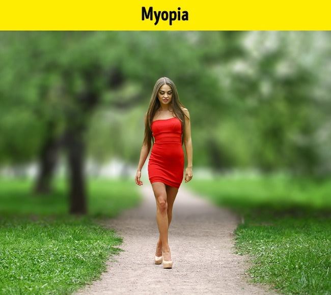 Myopia is a state of affairs when we see things relatively close relative, but we do not see distant things badly. So we have problems in identifying traffic signs, people who are far from us and do not see on the board.