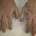 Home Made Mosquito Also For Ants and Fleas Repellents