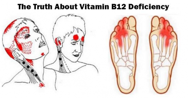 In 10 Minutes I Can Tell You All About Deficit In Vitamin B12