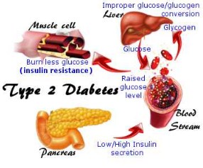 daun binahong untuk diabetes cara merebus daun binahong, resep daun binahong untuk diabetes, daun binahong untuk luka diabetes, aturan minum daun binahong, efek samping konsumsi daun binahong, khasiat daun binahong untuk rematik, makan daun binahong mentah, cara mengkonsumsi daun binahong untuk kesehatan